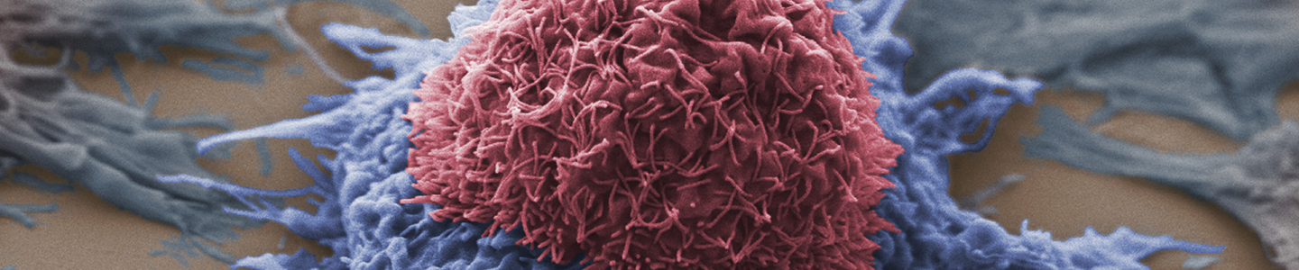 Blue and red lung cancer cells.