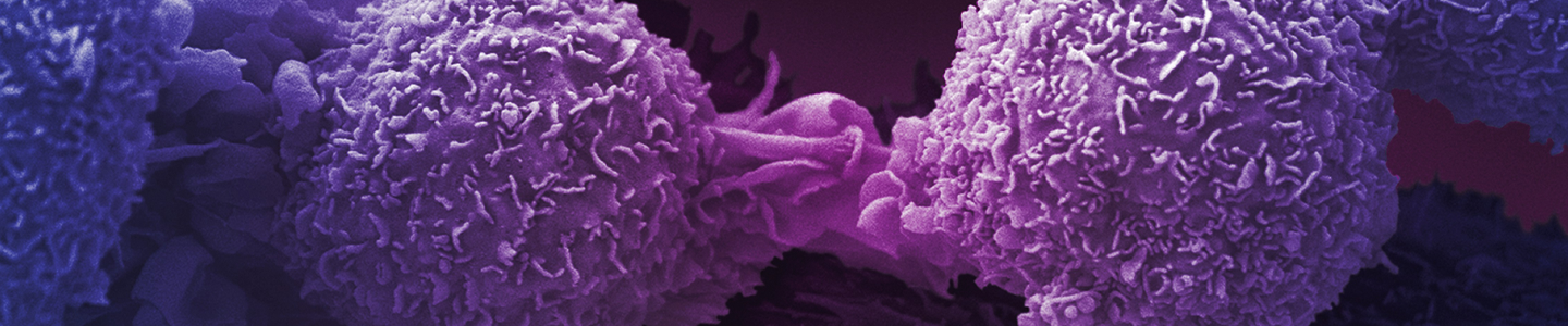 Purple lung cancer cells.