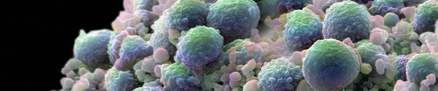Green prostate cancer cells.