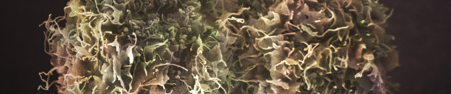 Pink and green skin cancer cells.