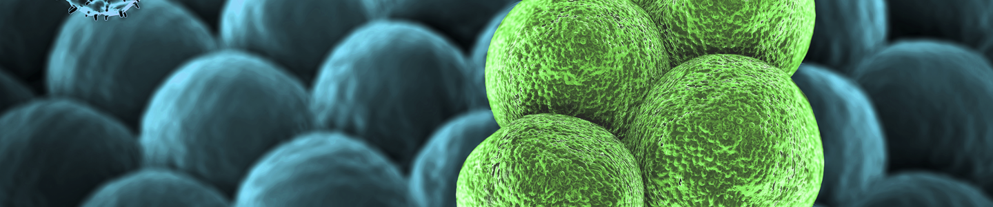 T-lymphocytes cancer cell.