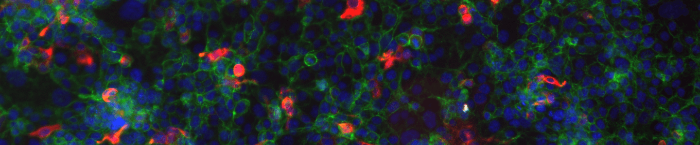 Fluorescent blue, red, and green colon cells.