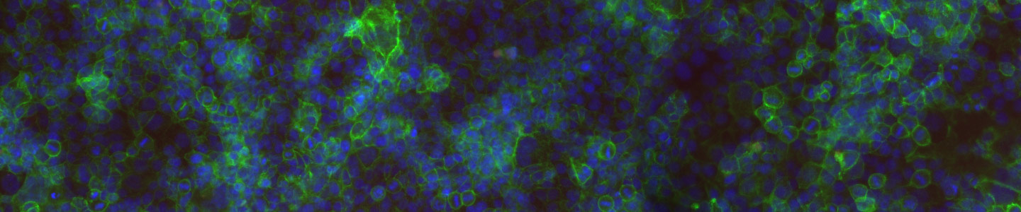 Fluorescent blue and green colon cells.