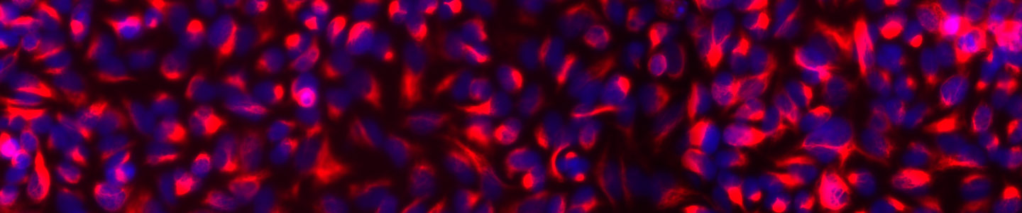 cells, EMT-MET, Lung EMT, VimRFP, pink, blue, mesenchymal, epithelial, transition,