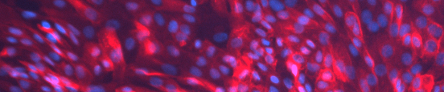 Blue and pink hTER renal proximal tubular epithelial cells.