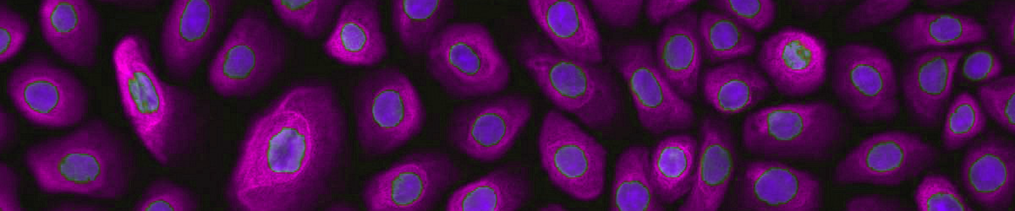 Purple and blue normal bronchial lung epithelial cells.