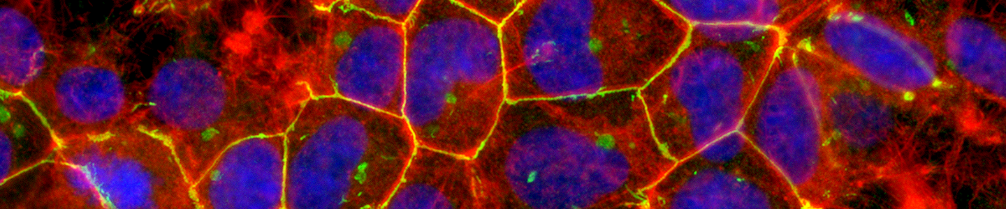 Red and purple HEK 293 stained protein.