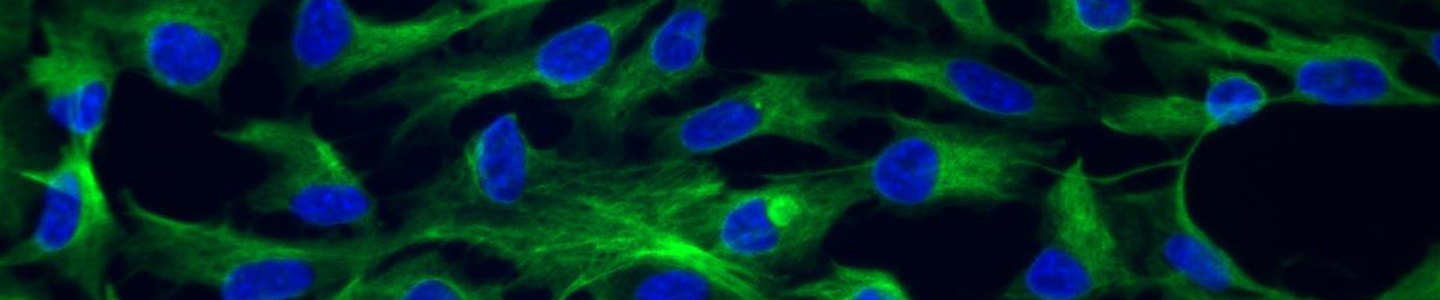 Red and blue retinal pigmented epithelial cells.
