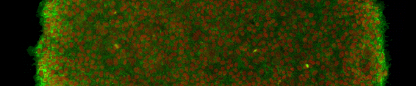 Green and red IPS stem cells.