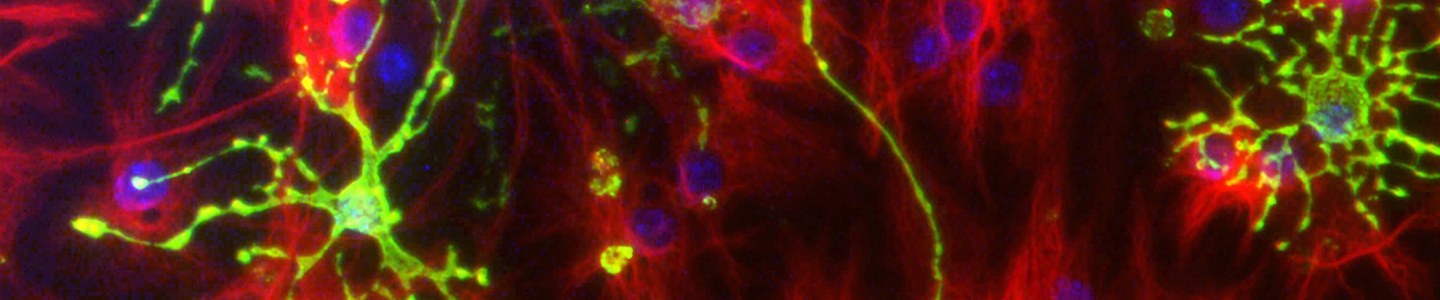 Astrocytes and oligodendrocytes from neural stem cells.