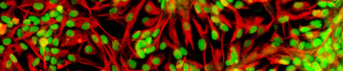 Red and green human neural stem cells.