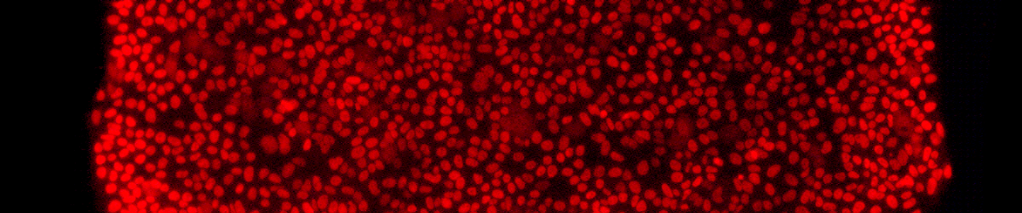 Red IPS nanog stem cells.