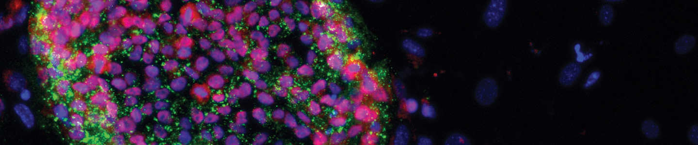 Purple and green induced pluripotent stem cells.
