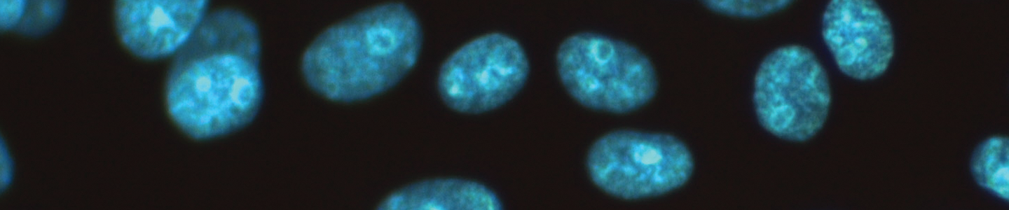 Vero neg control blue epithelial mycoplasma cells.