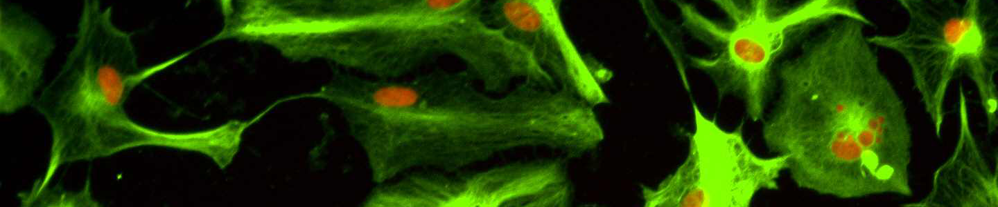 Green Oligodentrocytes neural progenitor cells.