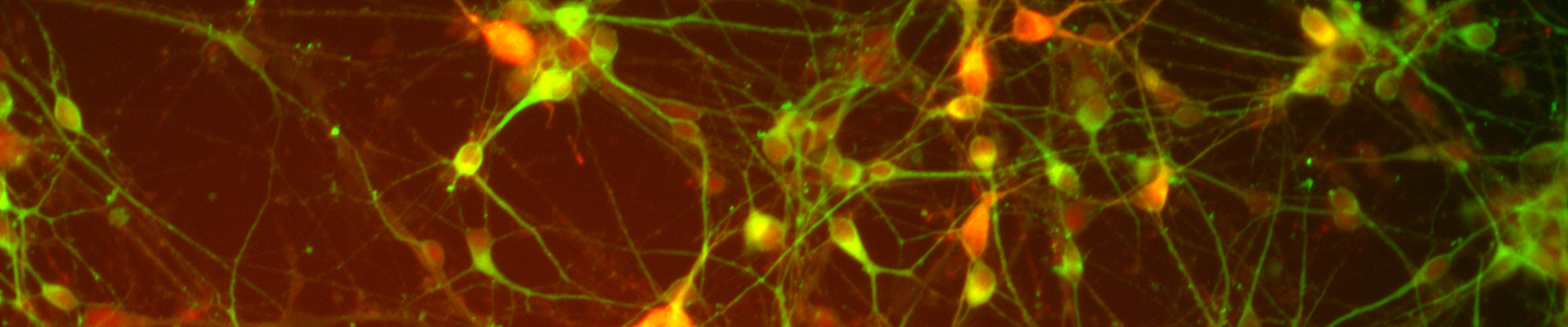 Green and orange dopaminergic neural progenitor cells 