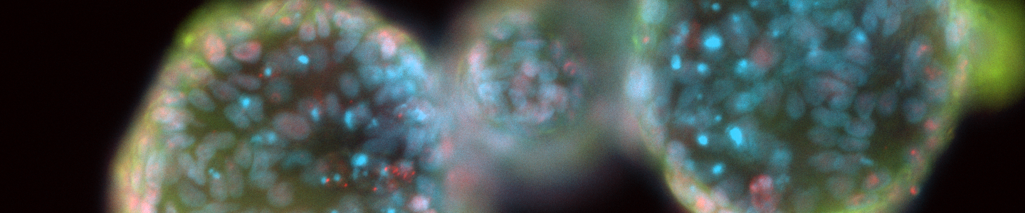 Blue and green 488 ck20 organoid cells.