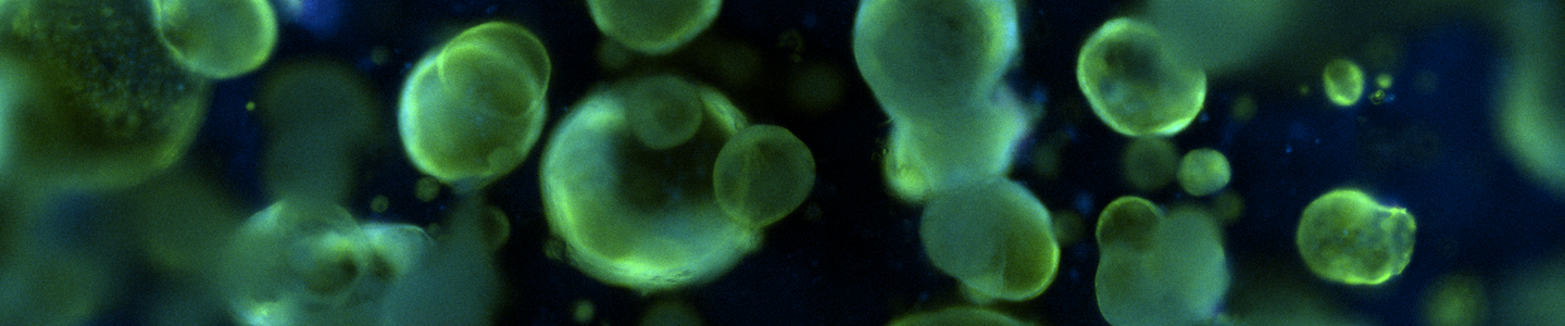 Green and blue organoid cells.