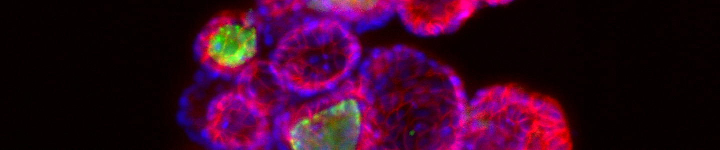 Purple and pink sanger11 ecad 647 organoid cells.