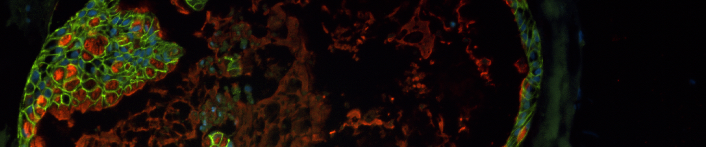 Green, red and blue organoid cells.