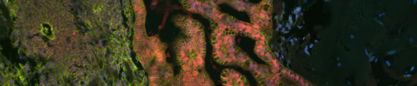 Green, pink and blue organoid cells.