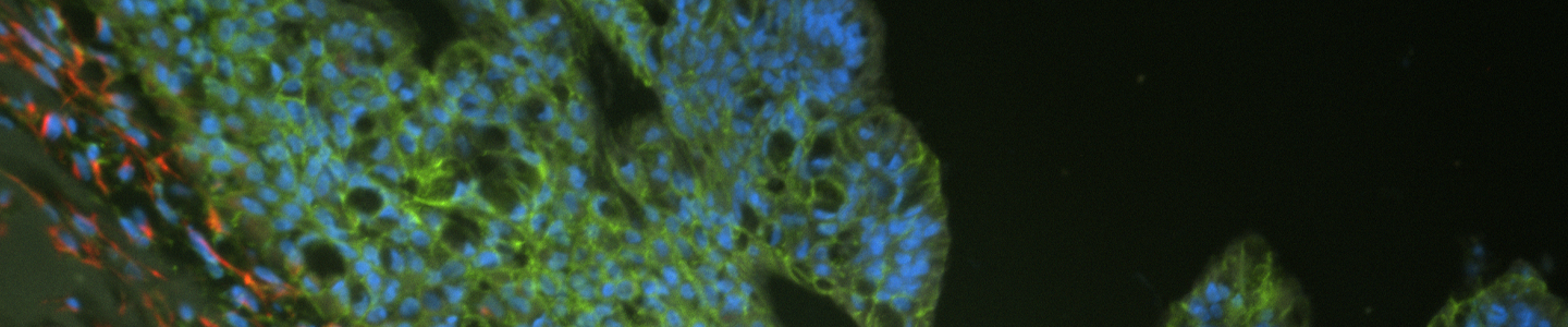 Orange, green and blue organoid cells.
