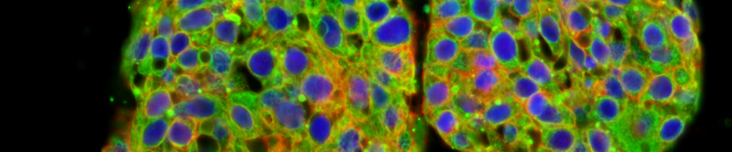 BT20 EGFR cell line.