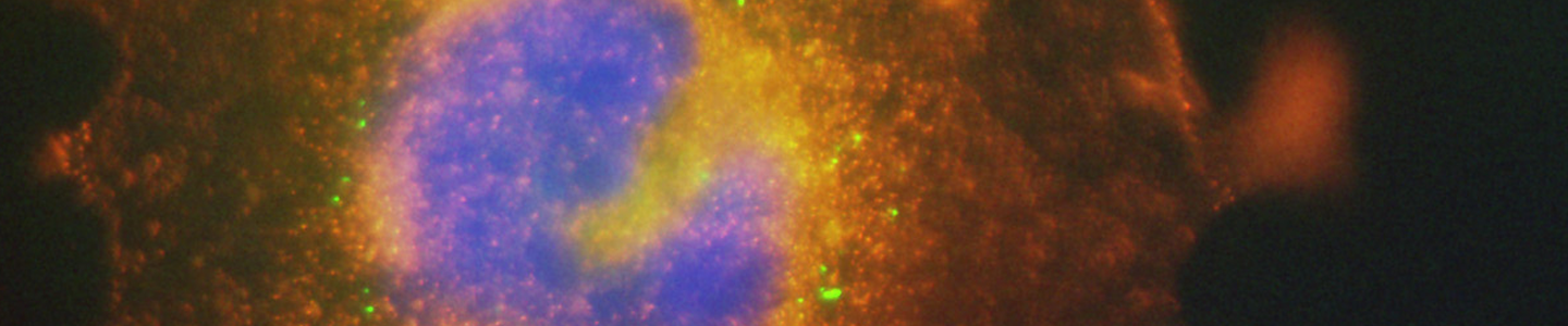 Blue and orange neuroblastoma cell.