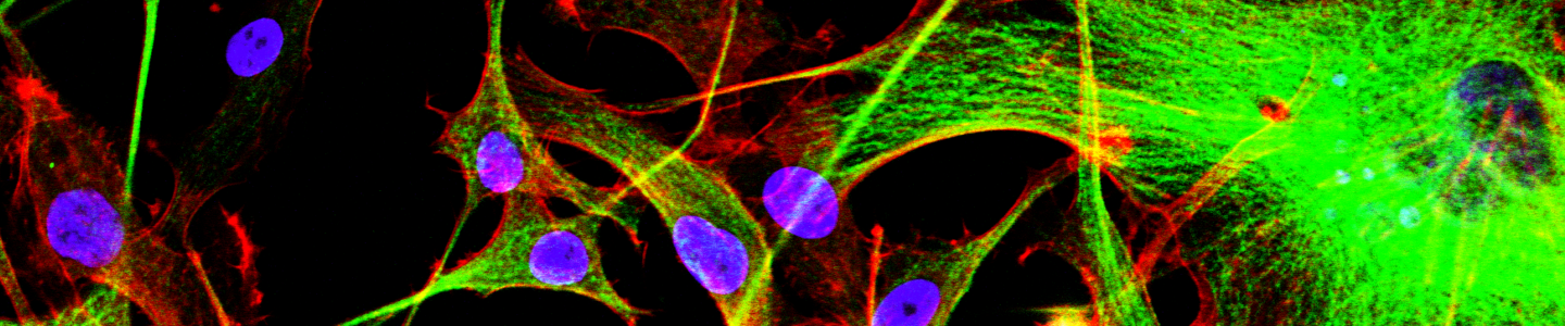 Green and red monolayer tubulin cells.