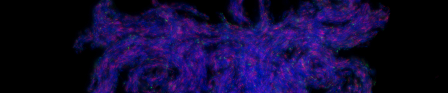 Blue mycobacterium ulcerans.