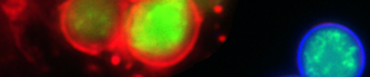 Greena and red yeast with macrophage cells.