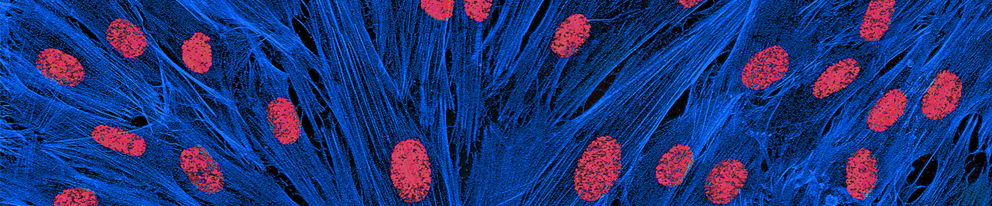 Red and blue fibroblasts.