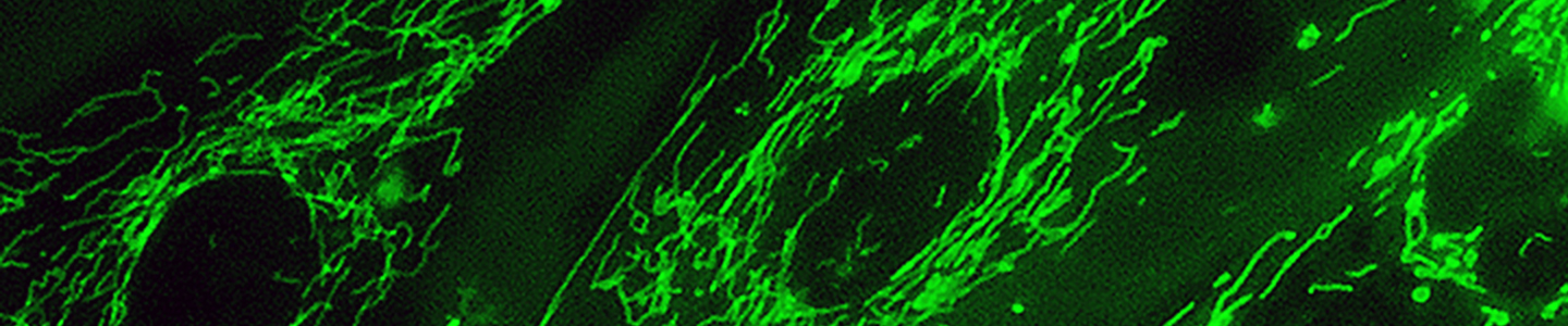 Green fluorescent mitochondria in 895 Sk cells.