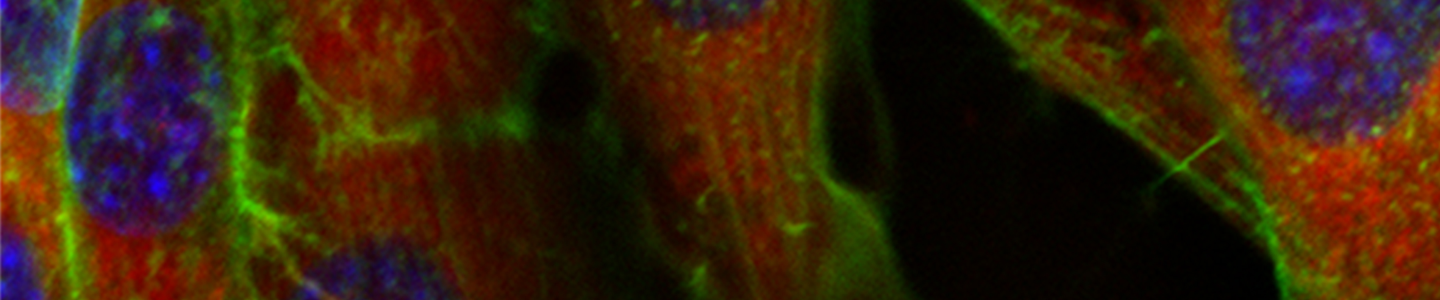 Blue green and red 3D fibroblasts.