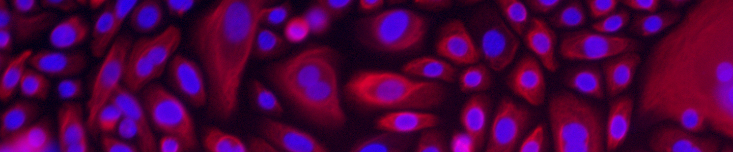 Red vaginal epithelial cells.