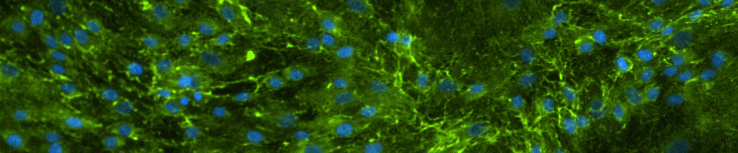 Green and blue gingival fibroblast.
