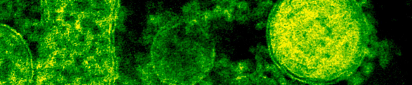 Green MERS-CoV cells.