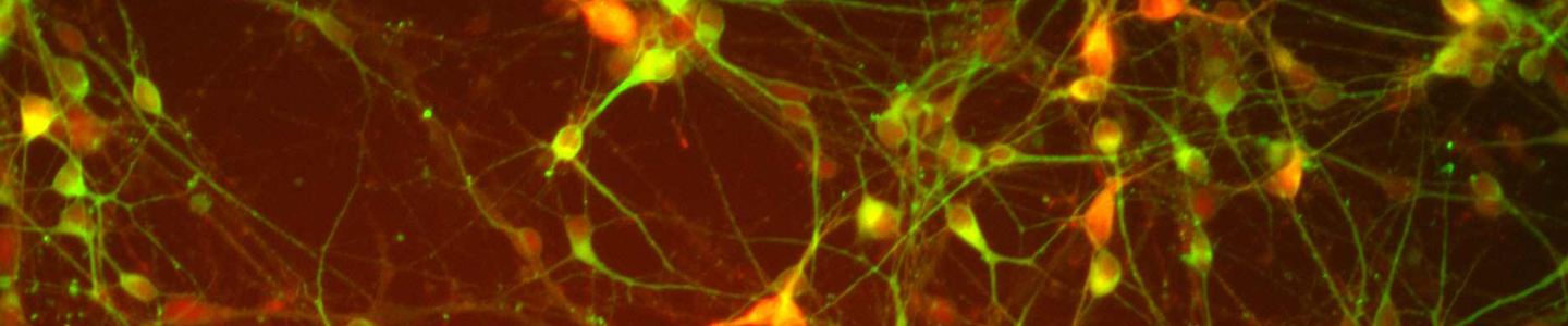 Red, yellow, and green dopaminergic Diff cells.