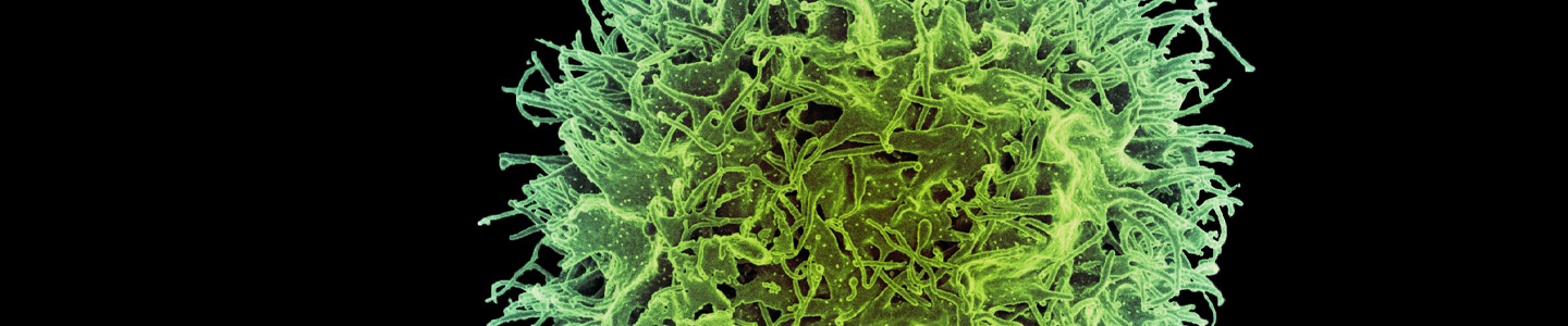 Green cluster of textured human natural killer cells with long, thin tendrils.
