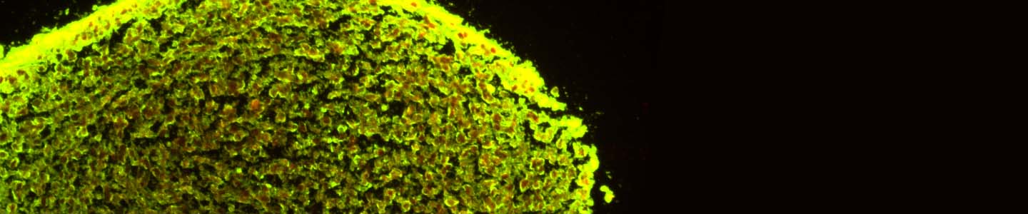 Neural progenitor cell derived neurosphere