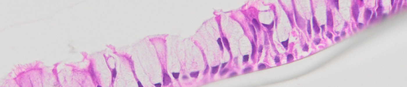 alcian blue stain airway histology primary bronchial cells
