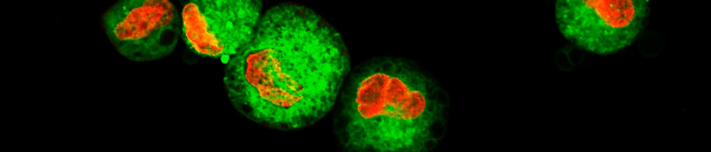 CAR-T cells, CAR-Target, CD19, CD20, HER2