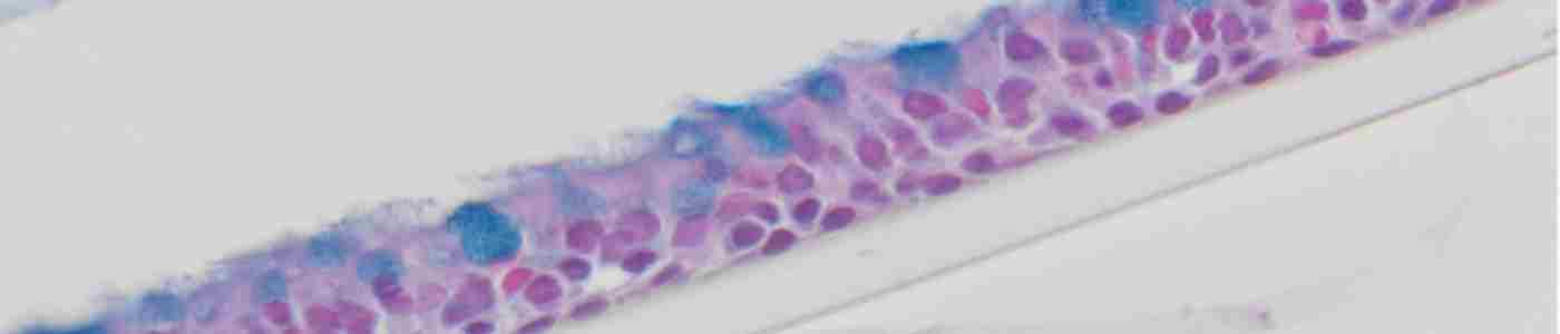 airway epithelium cilia goblet cells