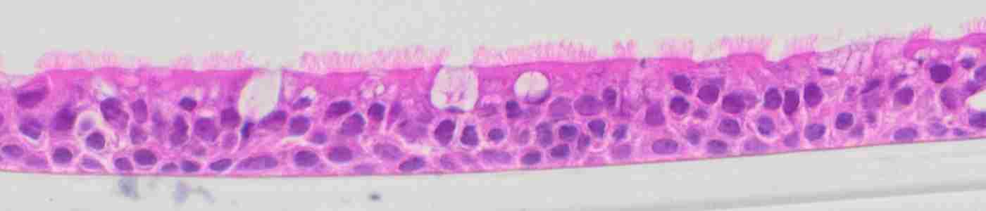 airway epithelium cilia goblet cells