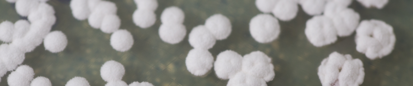 Small, white, fluffy balls of bacteria.