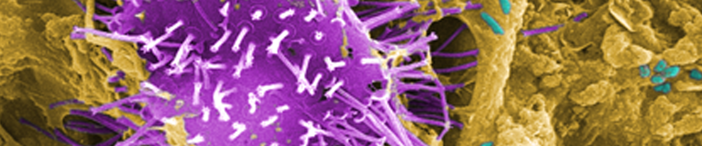 Untreated water specimen in purple, white and gold.