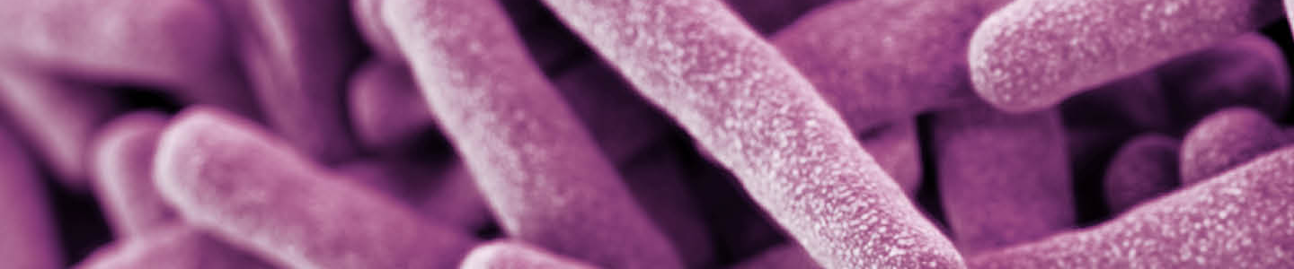 Cluster of thin, pink, rod-shaped Mycobacterium tuberculosis.