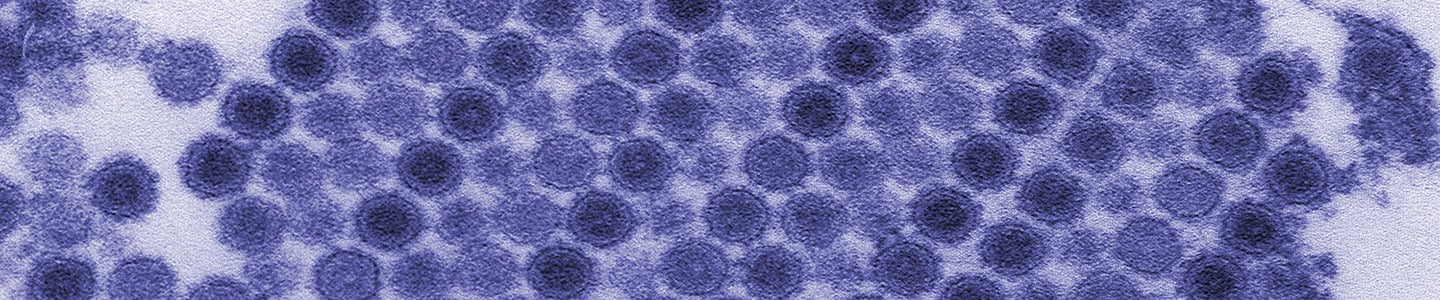 Tangled ball of blue and yellow ebola virus tendrils.
