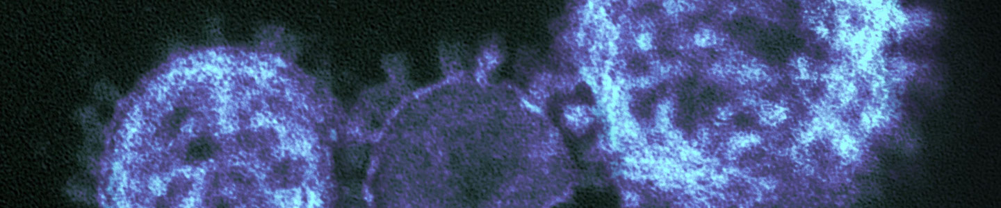 Grainy, blue and black translucent spheres of Middle East respiratory syndrome coronavirus.