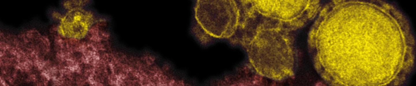 Grainy, pink and yellow spheres of Middle East respiratory syndrome coronavirus.